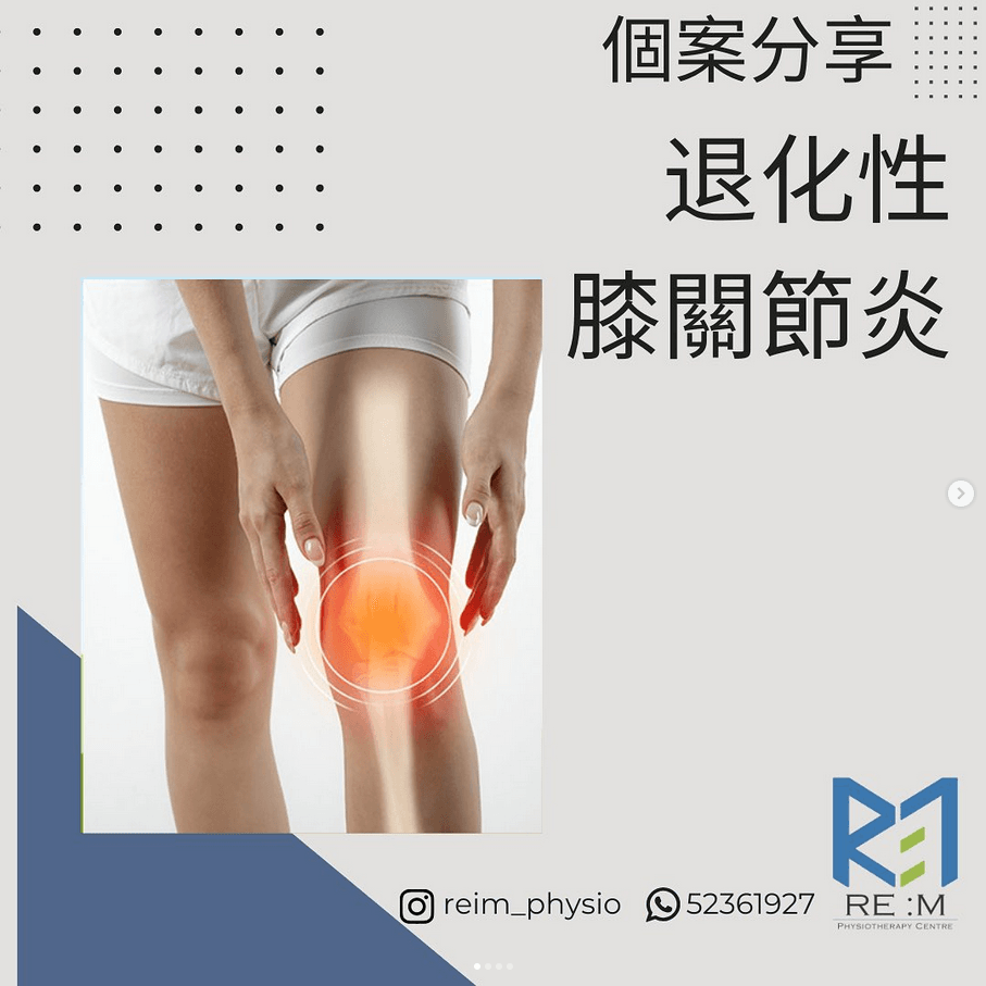 筋膜放鬆逆轉退化性關節炎