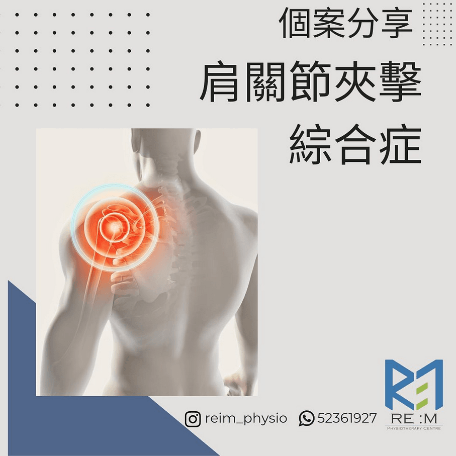 肩關節夾擊綜合症