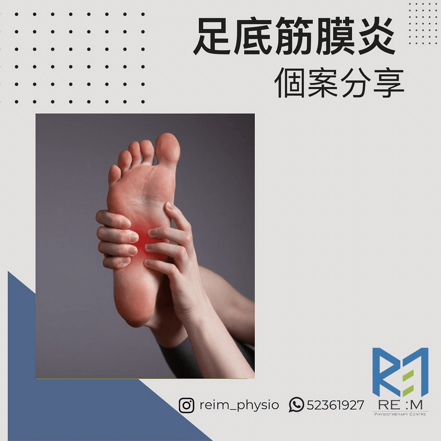 足底筋膜炎
